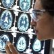 Promising results of new Alzheimer