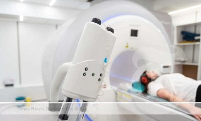 MRI neuronavigated Transcranial Magnetic Stimulation (TMS)