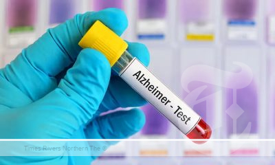 Alzheimer’s Blood Test