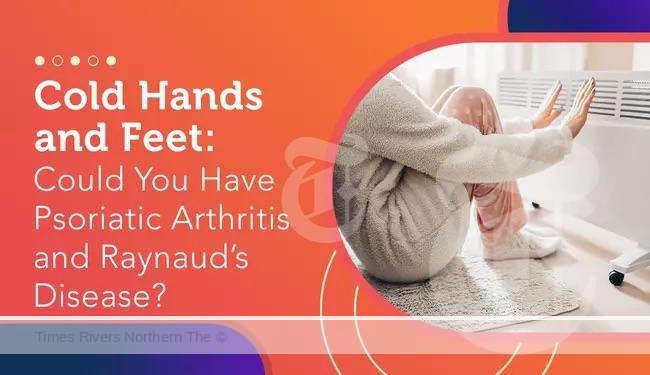 Psoriatic Arthritis and Raynaud's Syndrome indicators.