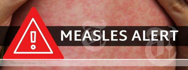 NSW Health has issued a measles alert for residents in northern NSW following confirmation of one measles case in Murwillumbah.