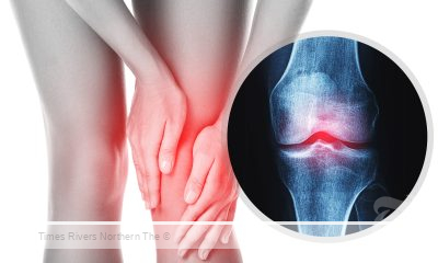 Osteoarthritis supplements research