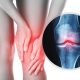 Osteoarthritis supplements research